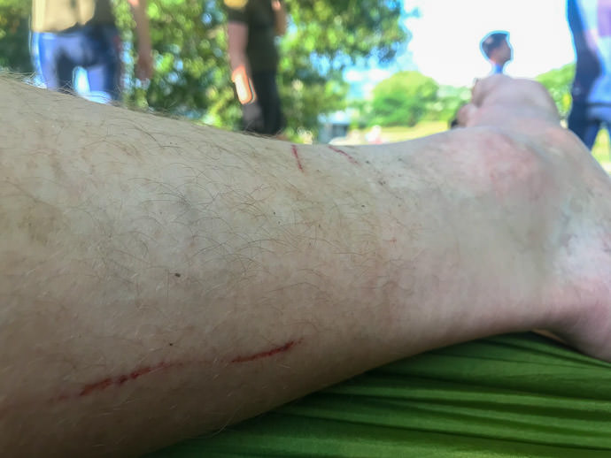 Some of my Battle Scars -- Kyoto, Japan -- Copyright 2021 Jeffrey Friedl, https://regex.info/blog/ Some of my Battle Scars -- Kyoto, Japan -- Copyright 2021 Jeffrey Friedl, https://regex.info/blog/